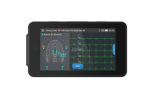 Lepu Medical Handheld PCECG-500 Карманный аппарат ЭКГ Портативный 12-выводной монитор ЭКГ для покоя для домашней клиники и первичной медико-санитарной помощи